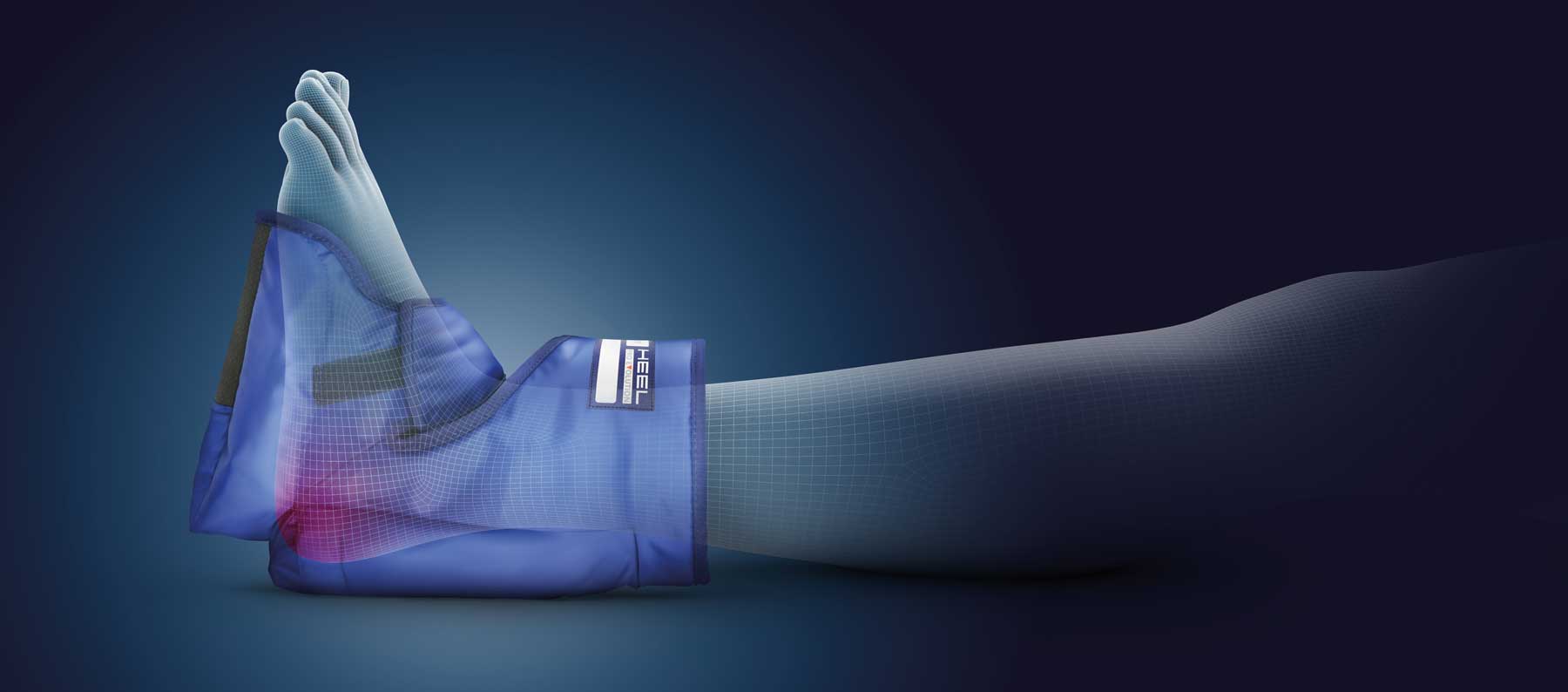 A Guide to Pressure Sores