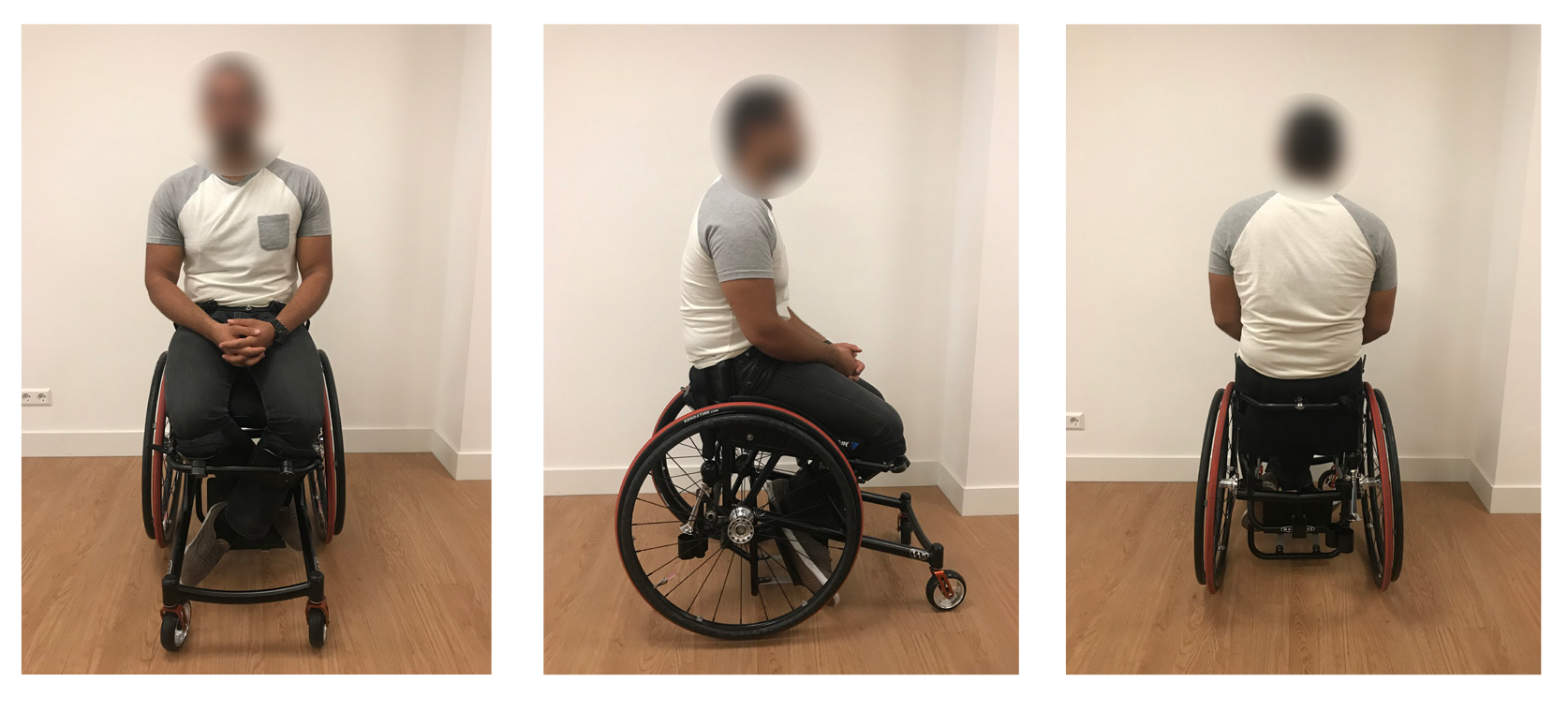 Clinical Case: Addressing a positioning challenge and handling shear forces involved